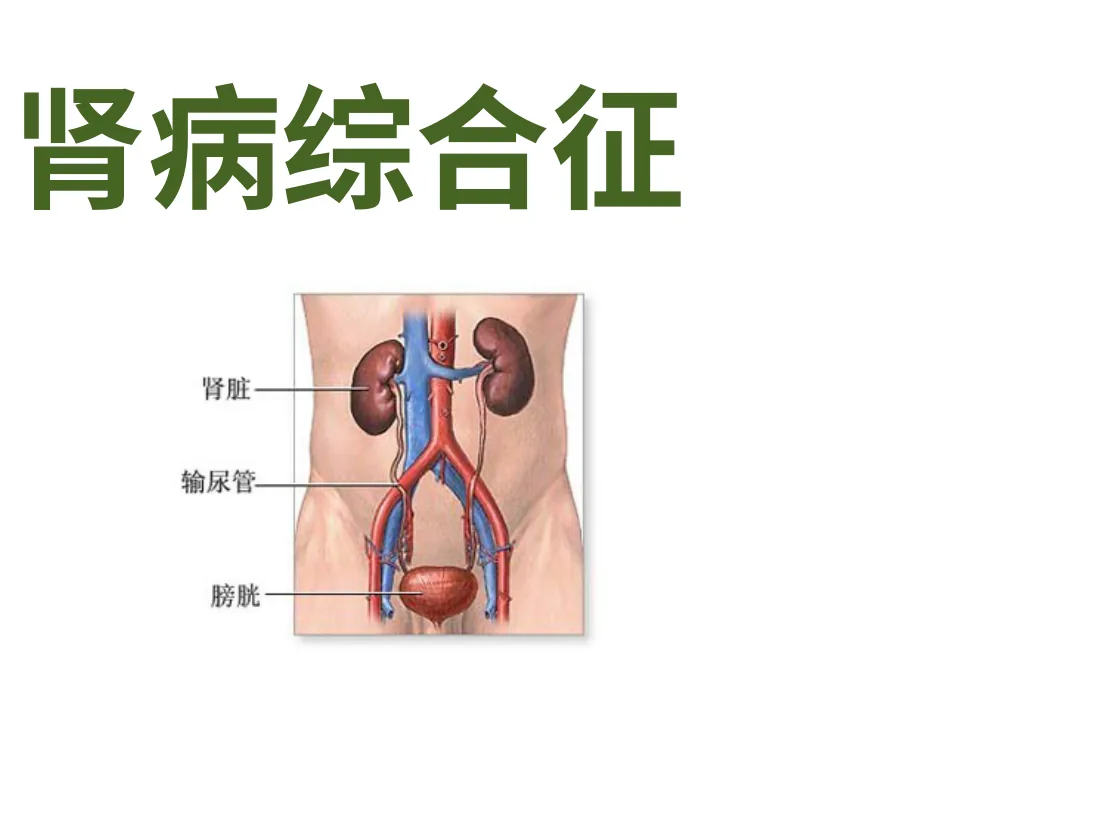 小儿肾病综合征