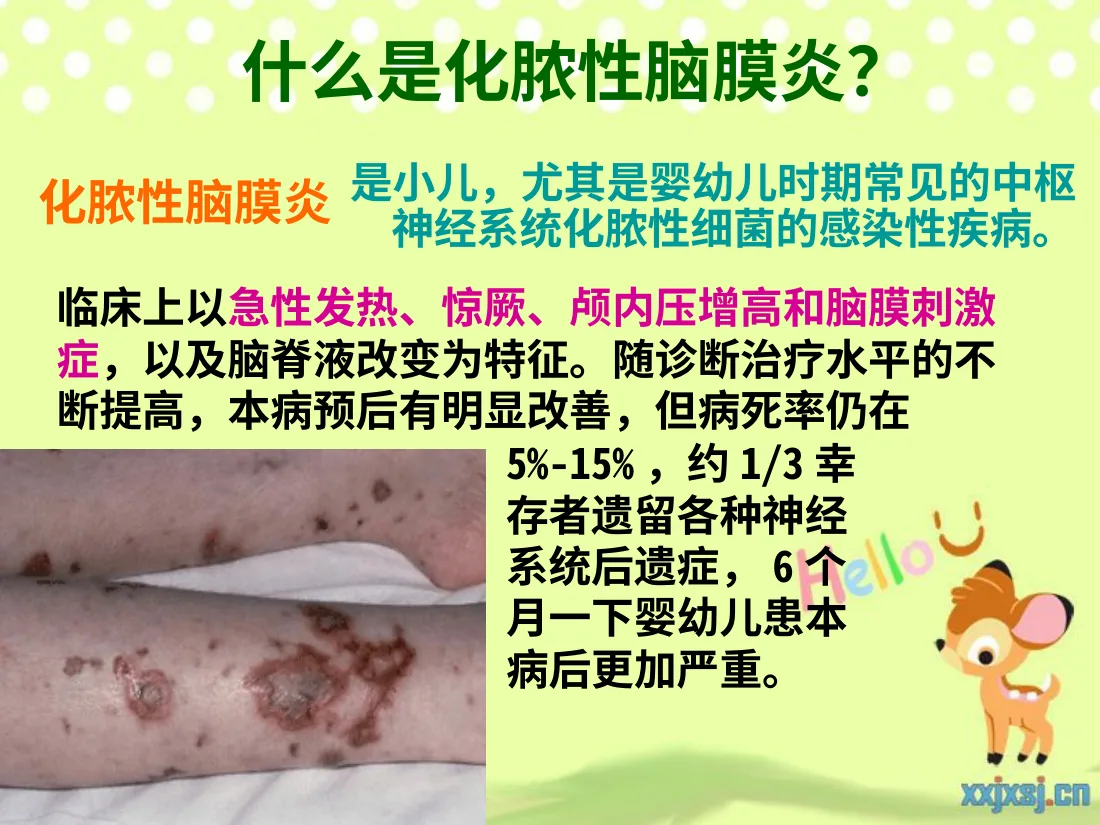 化脓性脑膜炎PPT 预览图