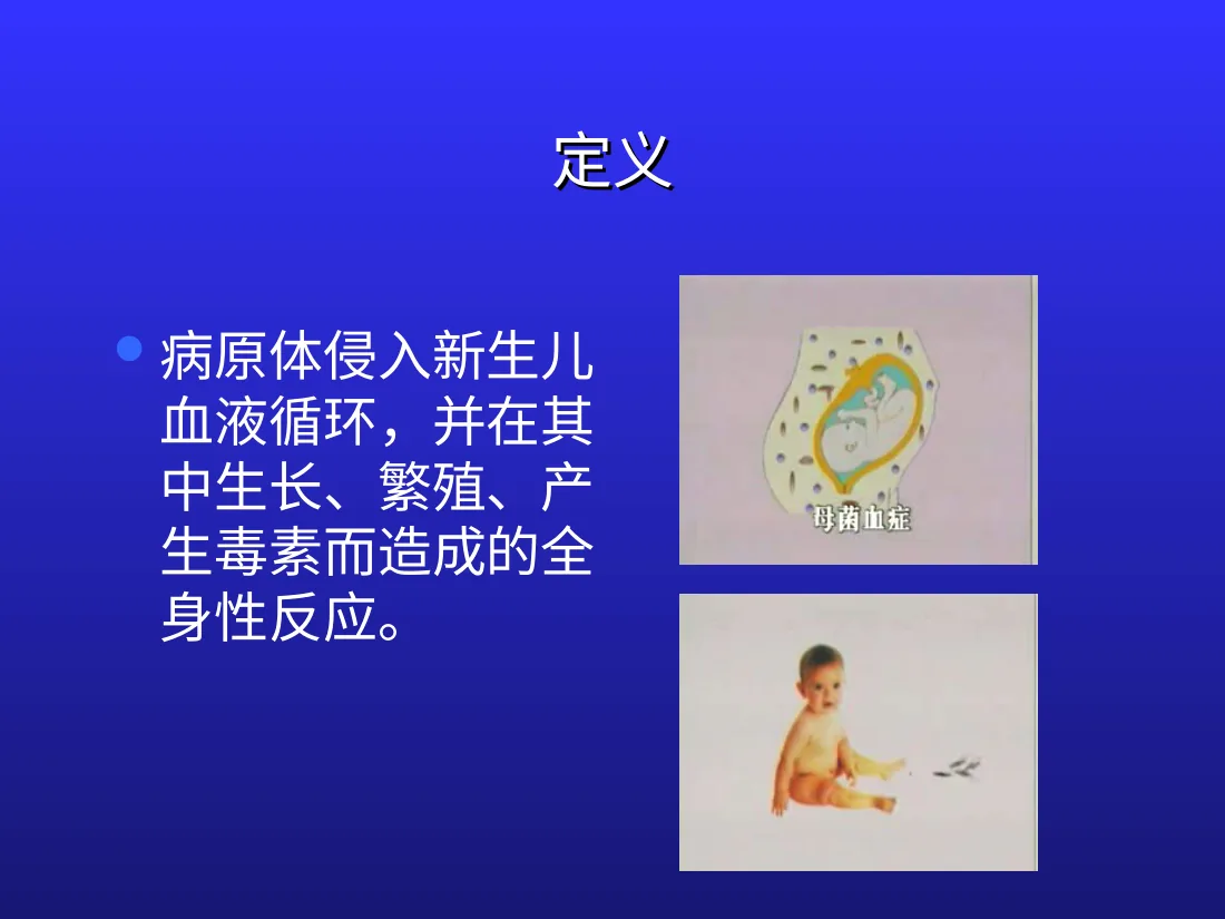 新生儿败血症 预览图