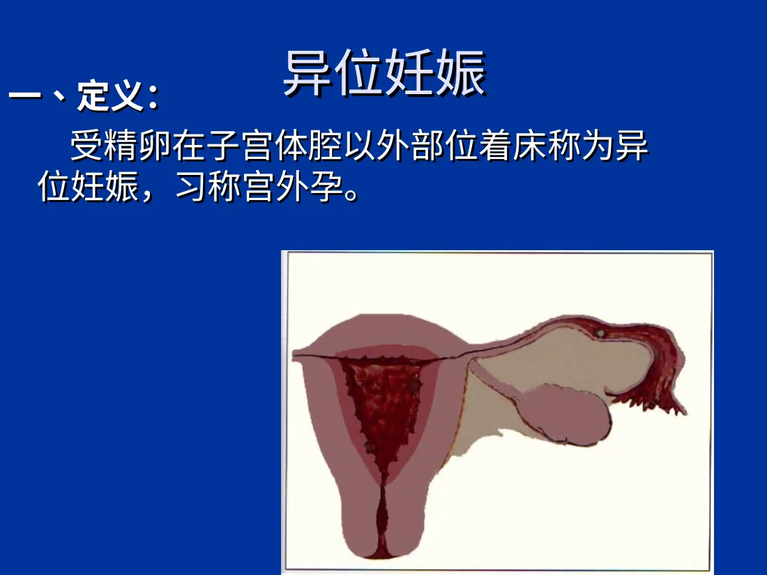 异位妊娠失血性休克的急救与护理 预览图