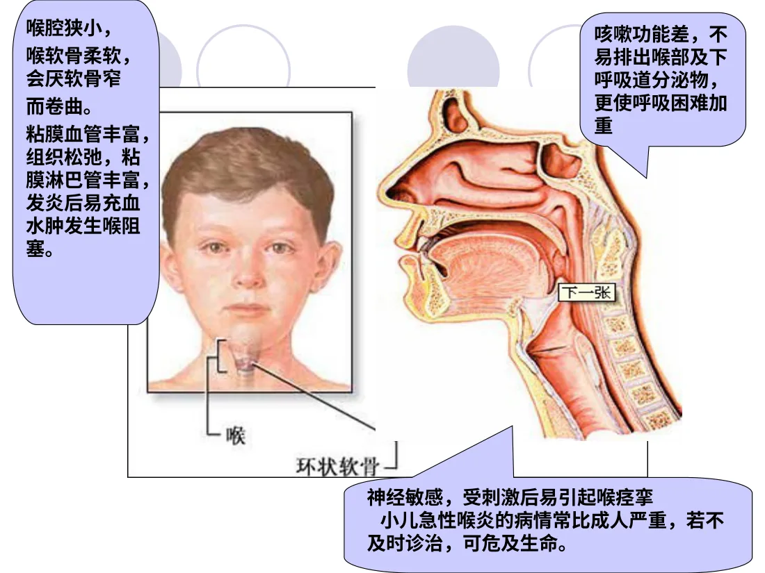 急性感染性喉炎 预览图