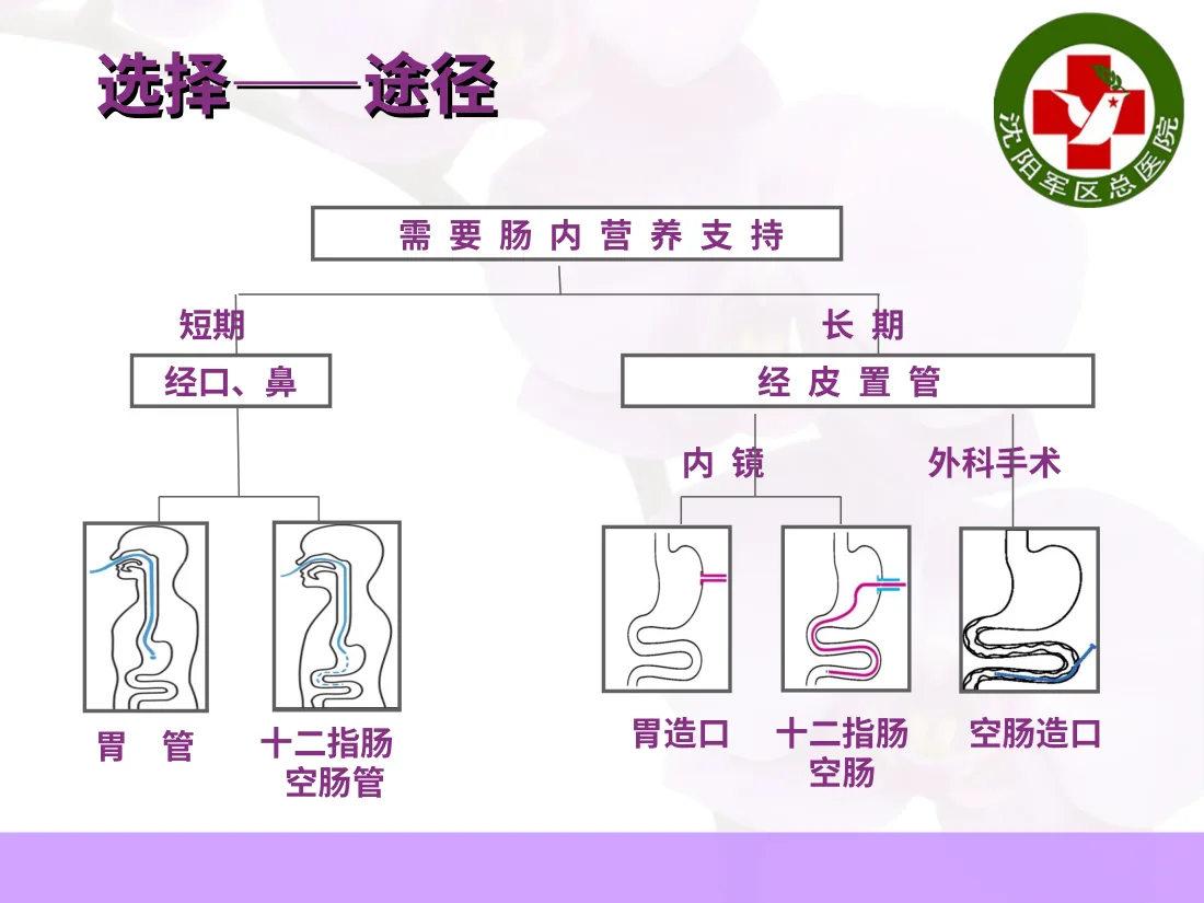 空肠喂养置管及维护 预览图