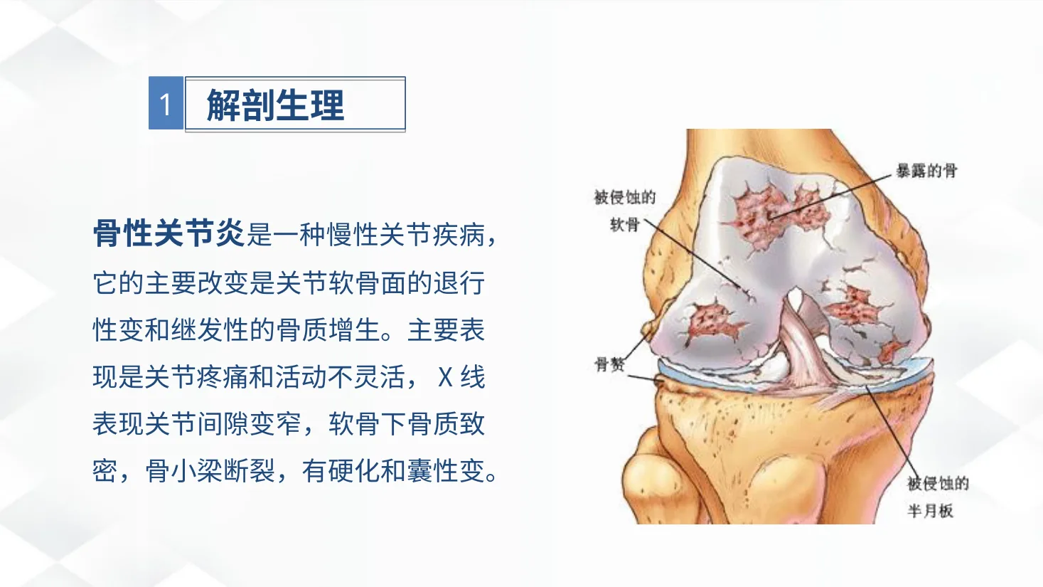08骨科 双膝骨性关节炎护理查房 预览图