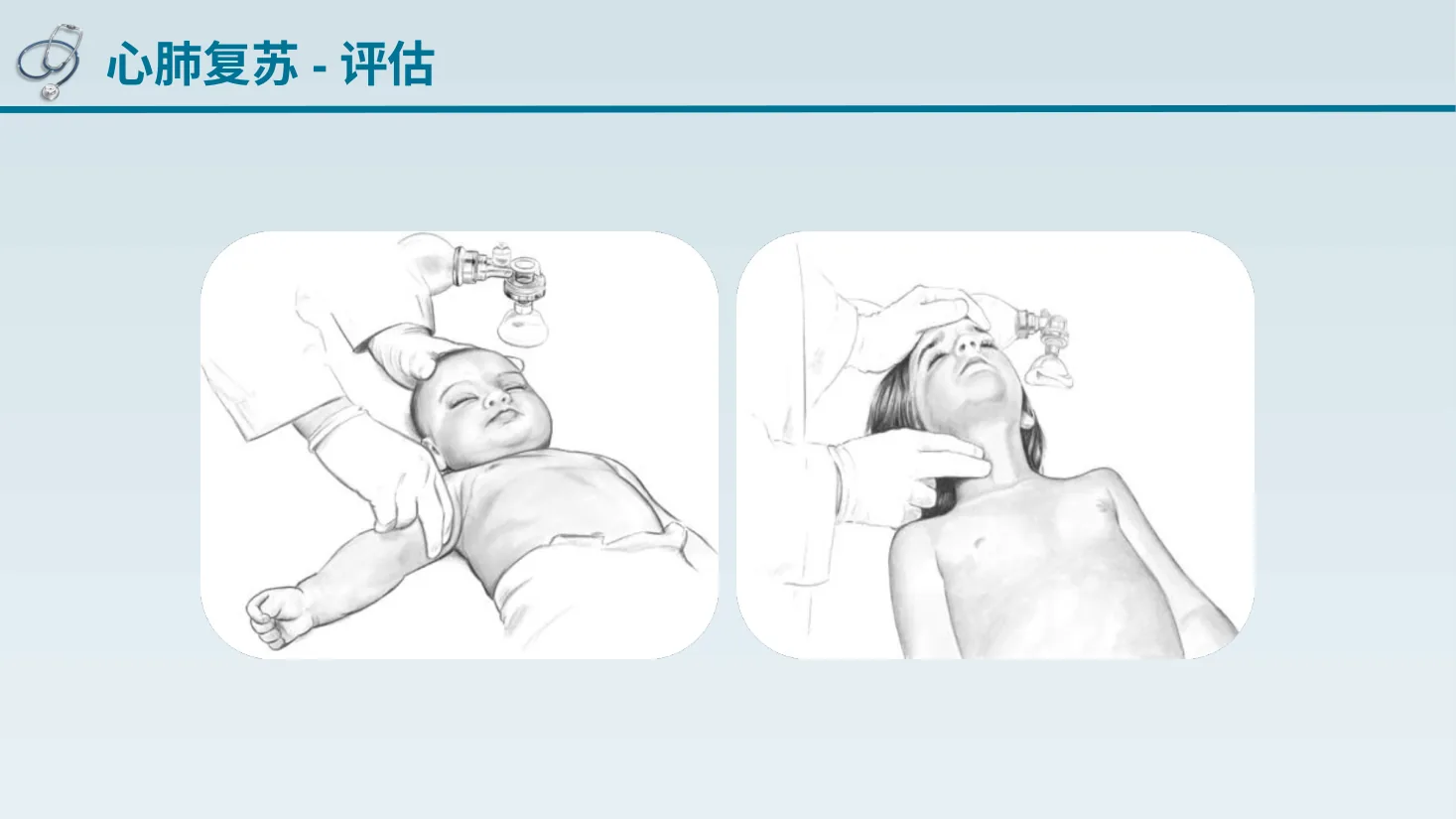 儿童心肺复苏 预览图