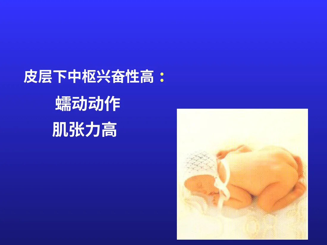 儿童神经心理发育 预览图