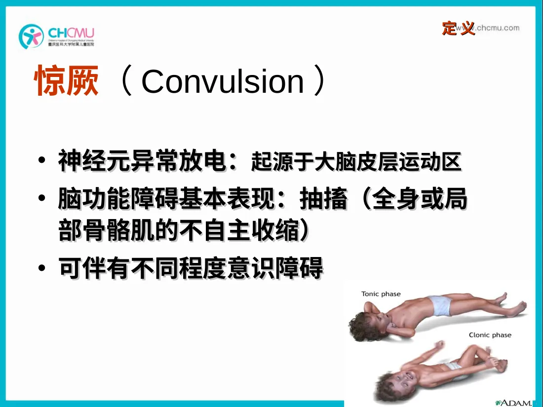 Acute convulsion in Children
J 预览图