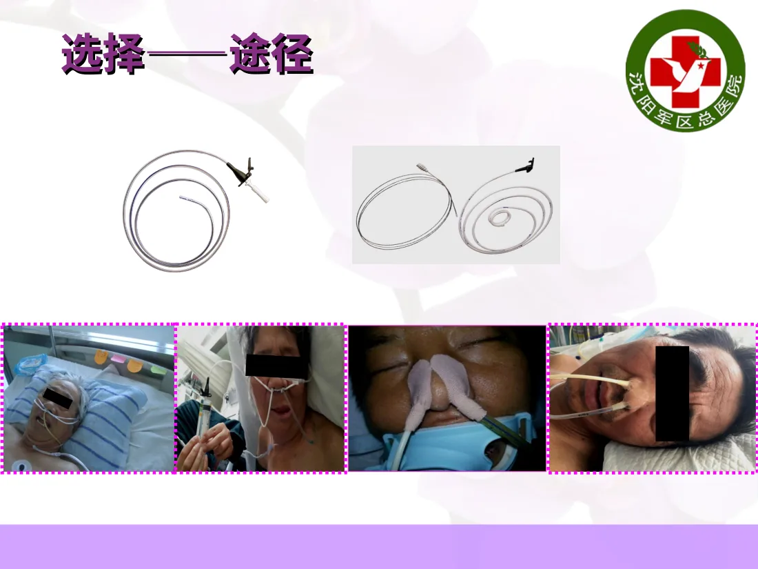空肠喂养置管及维护 预览图