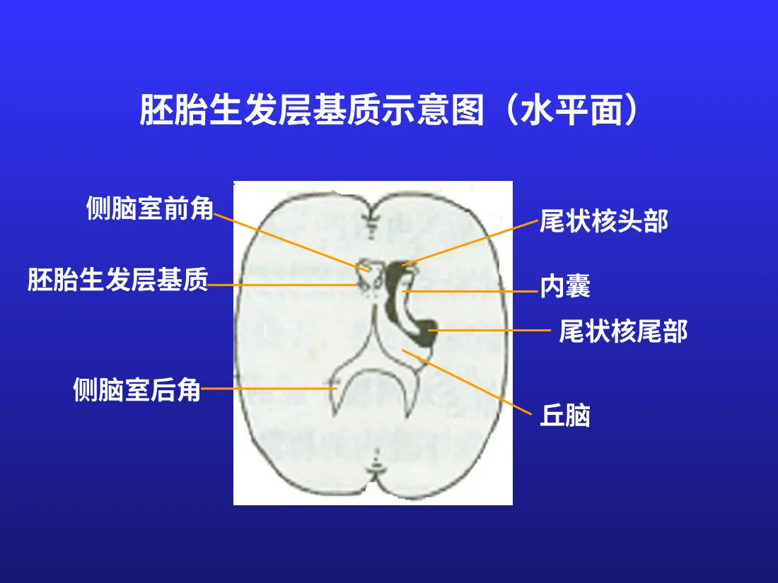 新生儿颅内出血 预览图
